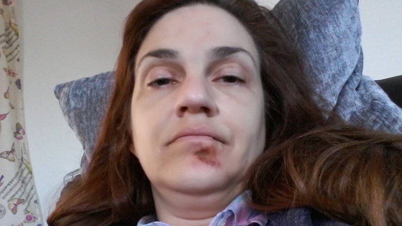 Firma esta PETICIÓN para implantar estudios y servicios sanitarios públicos para los SSC